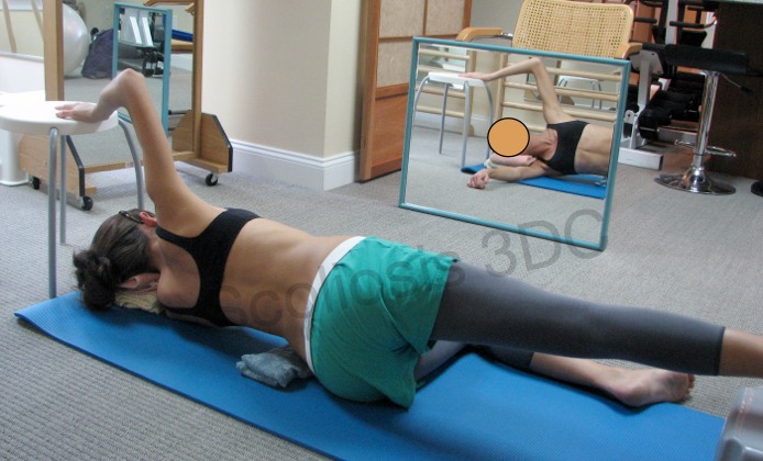 schroth method exercise, schroth method for scoliosis, scoliosis exercise