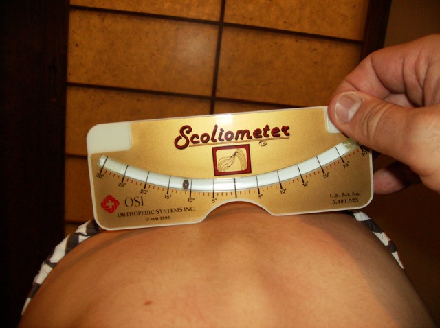 scoliometer