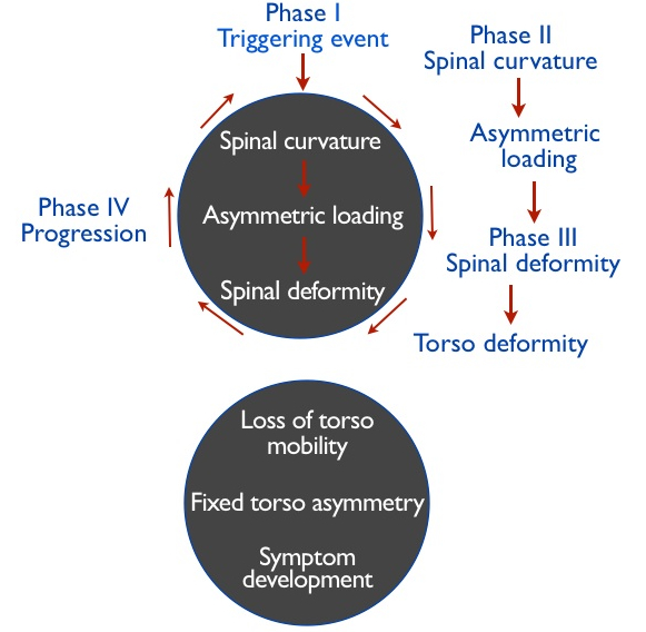 vicious cycle of scoliosis progression
