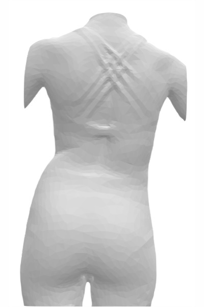 CAD CAM brace, brace design