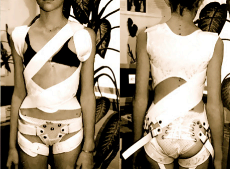 SpineCor brace