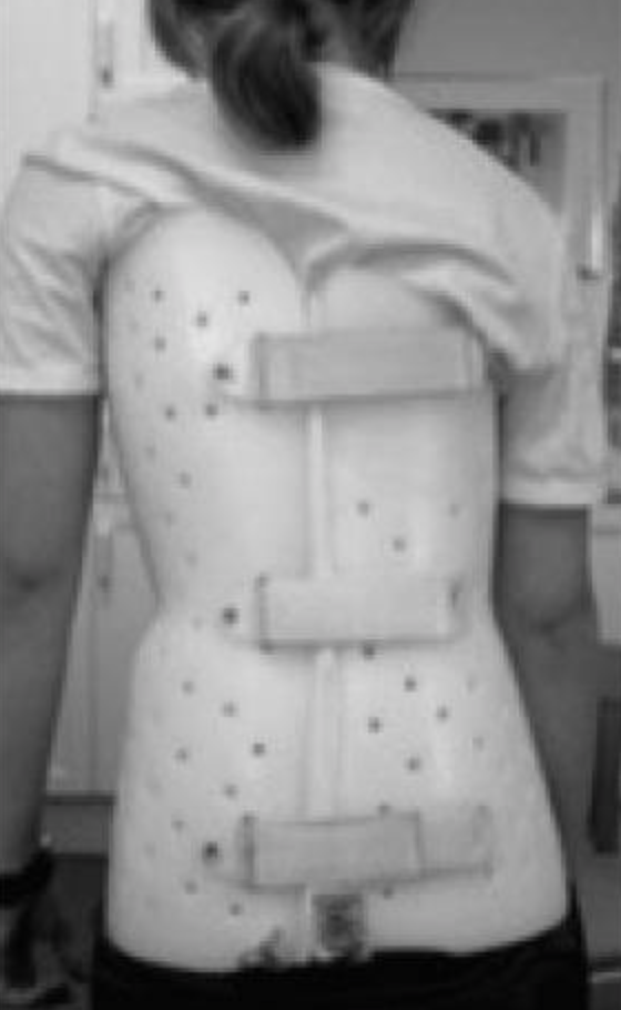 Boston brace for scoliosis