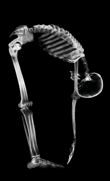 spinal flexibility and scoliosis